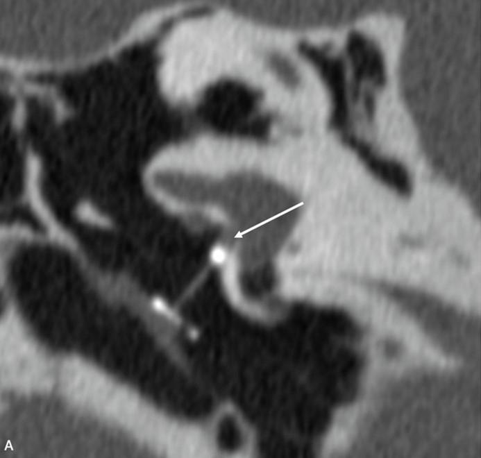 Picture2