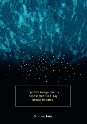 Objective image quality assessment in X-ray breast imaging